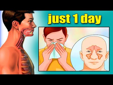 coughing up white phlegm but not sick coughing up white phlegm but not sick