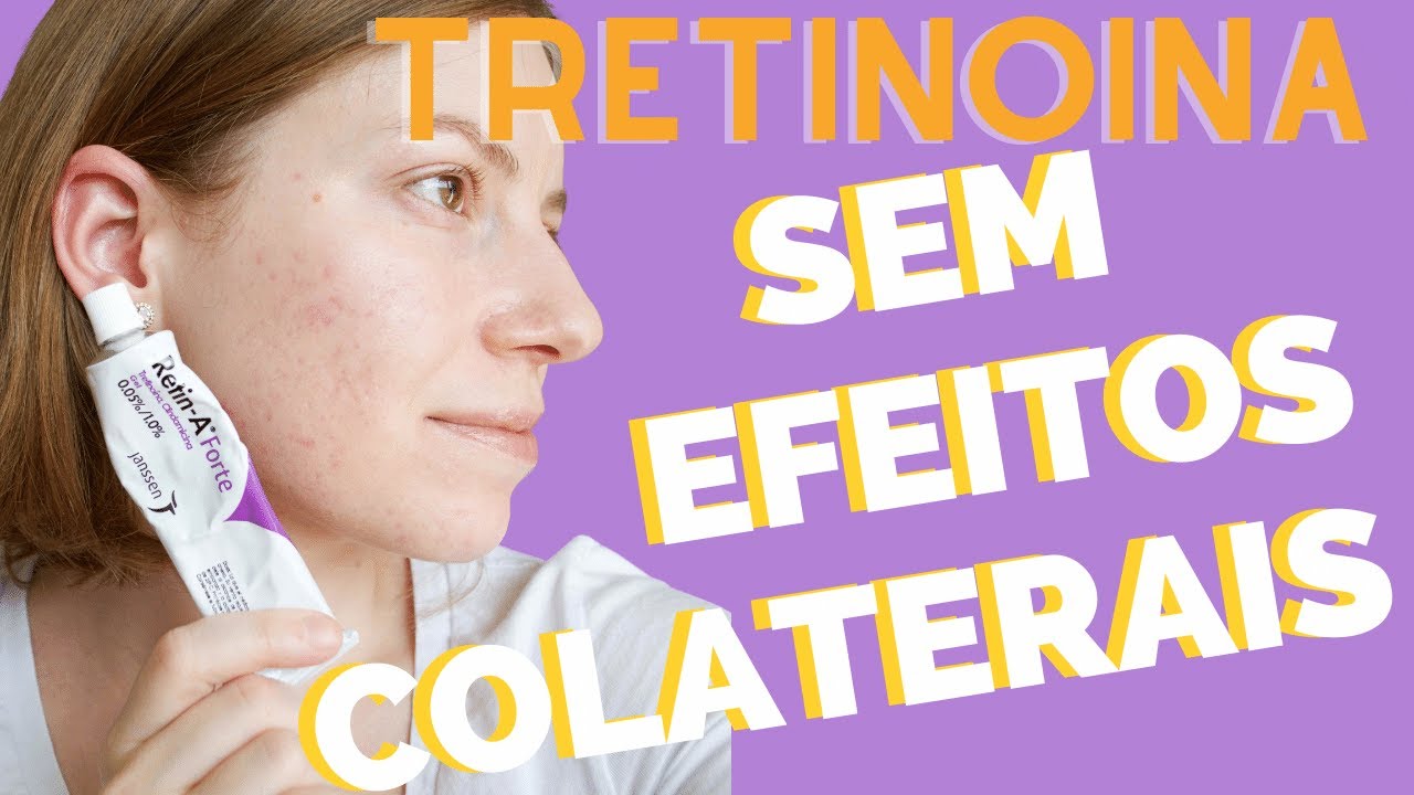 COMO COMEÇAR A USAR A TRETINOINA? | Vitanol A, Vitacid, Retin-A