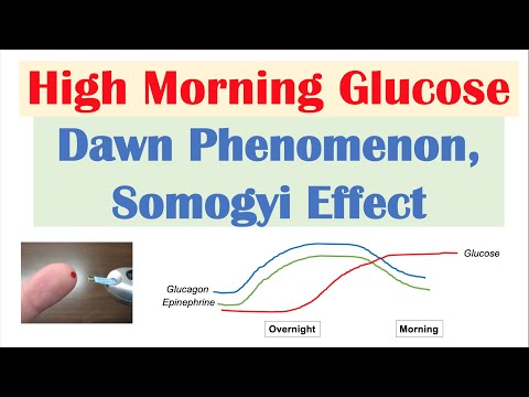 High Early Morning Glucose | Dawn Phenomenon & Somogyi Effect