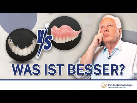 Fester oder herausnehmbarer Zahnersatz? Das musst du wissen!