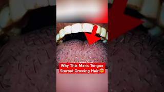 The Strange Condition Turning Tongues Black