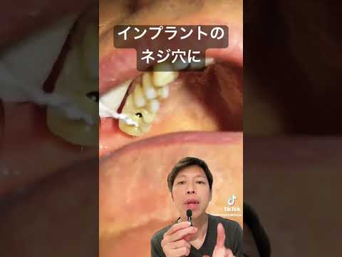 D2A: 他の毒性効果を有する非常に有毒な物質