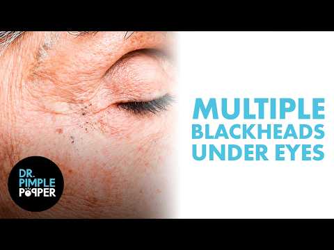 Drpimplepopper