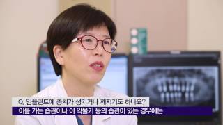 임플란트에 <b>충치</b>가 생기거나 깨지기도 하나요? 미리보기 썸네일