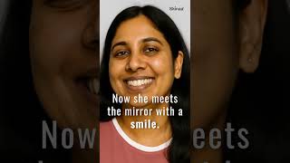 Download lagu Melasma Treatment at Skinaa – Restore Your Natural Glow #viral #ytshorts #skincare mp3 Download lagu Melasma Treatment at Skinaa – Restore Your Natural Glow #viral #ytshorts #skincare mp3