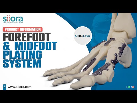 PRODUCT INFORMATION FOR FOREFOOT MIDFOOT PLATING SYSTEM | SIORA SURGICALS