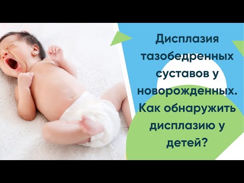 Дисплазия тазобедренных суставов у новорожденных. Как обнаружить дисплазию у детей? Симптомы