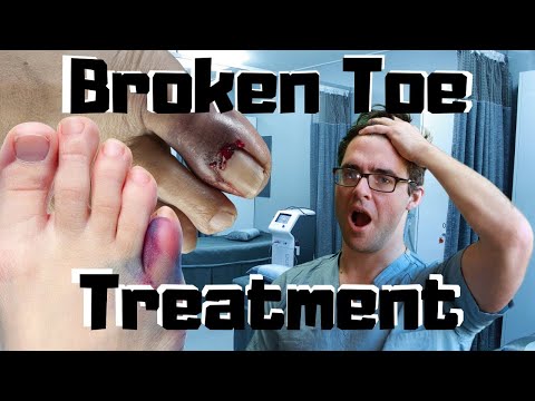 BEST 25 Plantar Fasciitis HOME Treatments Massage Stretches Shoes