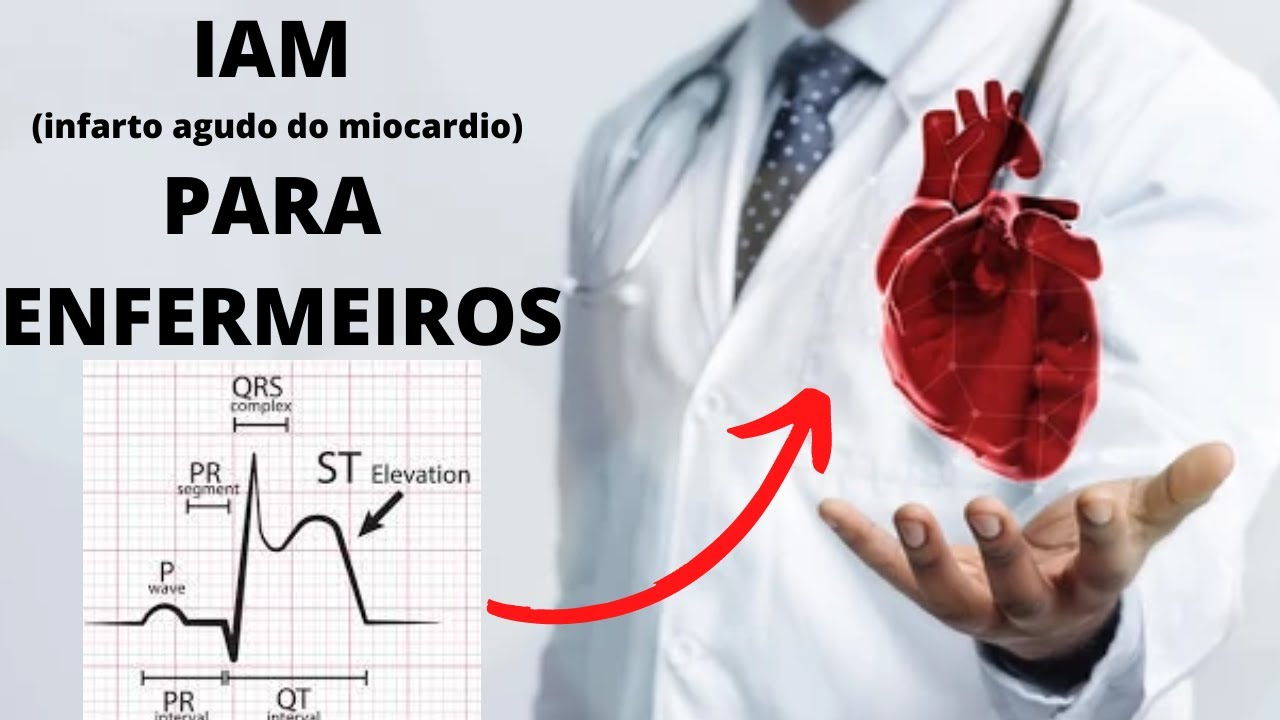 Aula 1 IAM com Supra ST - O que preciso Saber sobre IAM (Infarto Agudo do Miocárdio com supra de ST)