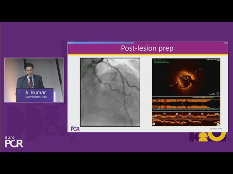 Transforming PCI: mastering the implementation of drug-eluting balloons - EuroPCR 2025
