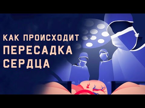 Как происходит пересадка сердца