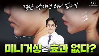 미니거상, 이거 모르면 100% 실패합니다