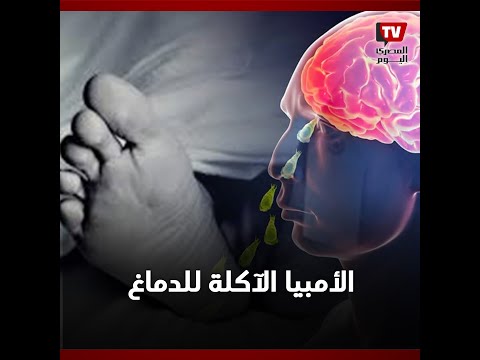 الأمبيا الآكلة للدماغ.. دولة أسيوية تسجل أول إصابة بالمرض القاتل