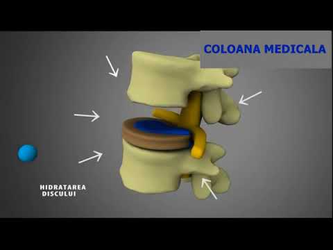 Ce unguente sunt mai bune pentru osteochondroza - Varietăți de produse farmaceutice