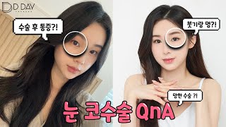 [성형브이로그] 아 나 망했나... 눈코성형 후회..? .. 2달차 심경?