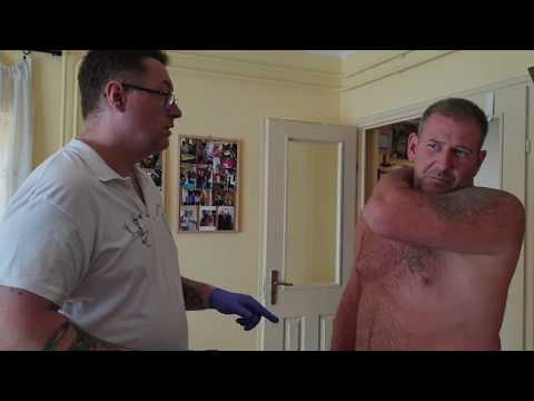 Prostatitis Wormwood kezelése