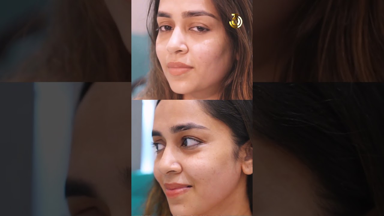Pramudi Karunarathne’s EM Face Final Treatment | 360 Aesthetics