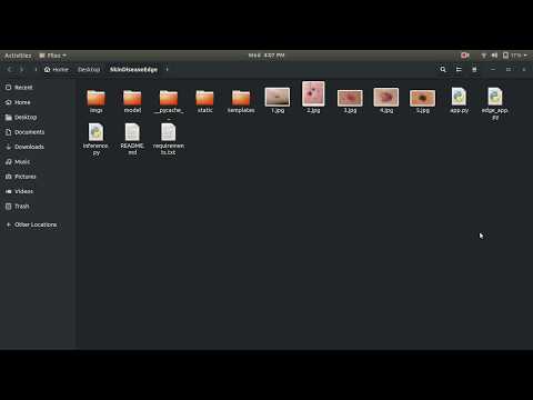 GitHub - denilgabani/skin-disease-detection-edge: Skin Disease ...