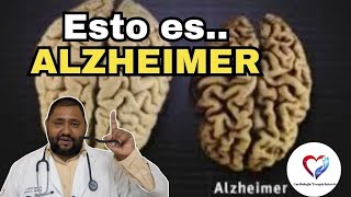 Estos son síntomas de Alzheimer que suelen ignorarse… hasta que es demasiado tarde”