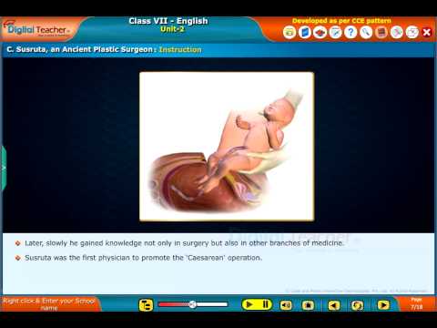 Susruta, an Ancient Plastic Surgeon, Class 7 English | Smart Class