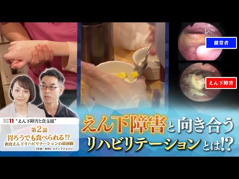 栄養学科 BS11放送番組・第2話【胃ろうでも食べられる⁉︎】 えん下障害と向き合う　リハビリテーションとは⁉︎