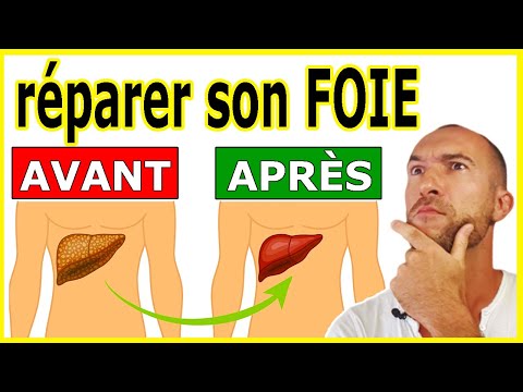 Comment Éliminer La GRAISSE Sur Le FOIE : 5 ALIMENTS à Consommer