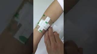 Download lagu waterproof pu wound dressing mp3