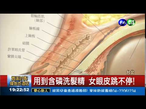 用到含磷洗髮精 女眼皮狂跳!