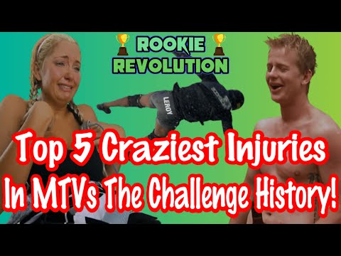 Top 5 Craziest Injuries in MTV's The Challenge History!
