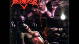 Cover art for Gorgasm- Anal skewer
