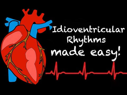 EMS Cardiology || Tachy Tuesday: Idioventricular Rhythms in EMS