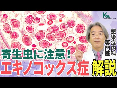 粘液虫症について詳しく解説