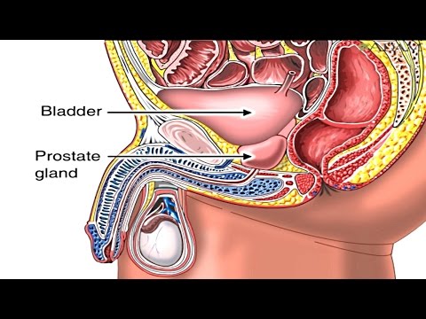 Was ist Prostata-Infektion Prostata-Massage Moskau ENEA