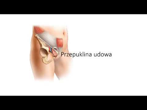 Maszyna, która stepper ćwiczenia mięśni pociągi Bóle mięśni w leczeniu ramię