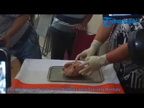 Cara terbaik untuk meningkatkan potensi pada pria Madu dengan potensi sebagai mengambil