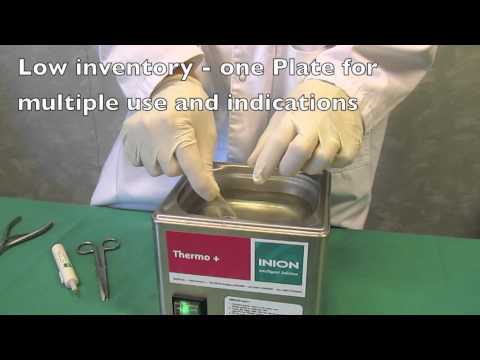 Inion FreedomPlate™ Modification Instructions