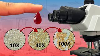 Esto es lo que vi en mi sangre al microscopio… ¡INCREÍBLE!