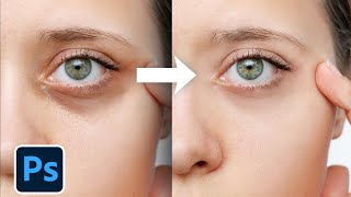 Photoshop: Remove Dark circles & Bags Using Solid Color