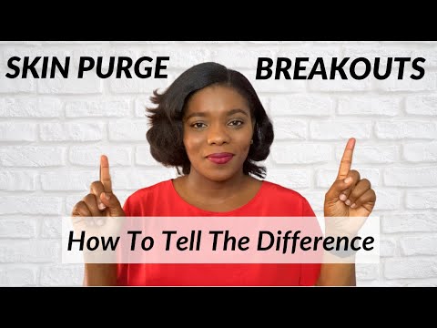 How To Tell If Your Skin is Purging Or Breaking Out | Skin Purge Vs Breakouts - Dr. Janet
