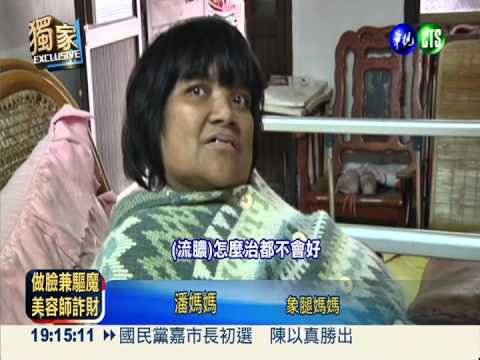 貧病交迫養身障女 救救象腿媽!