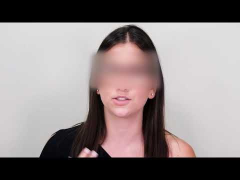 Elelyft Lip Lift Testimonial UES