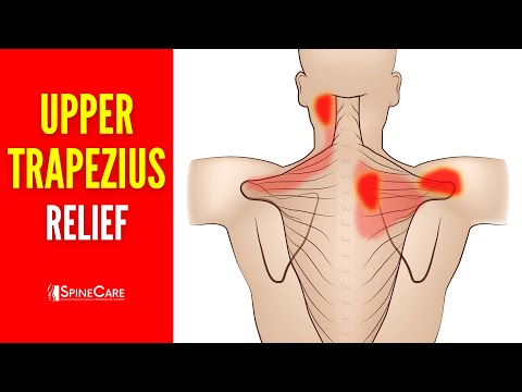 How to INSTANTLY Fix Upper Trapezius Pain