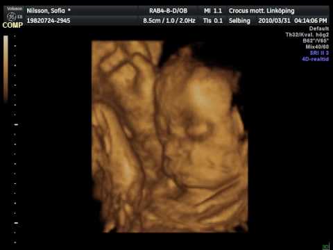 Vår lilla prinsessa i graviditetsvecka 27