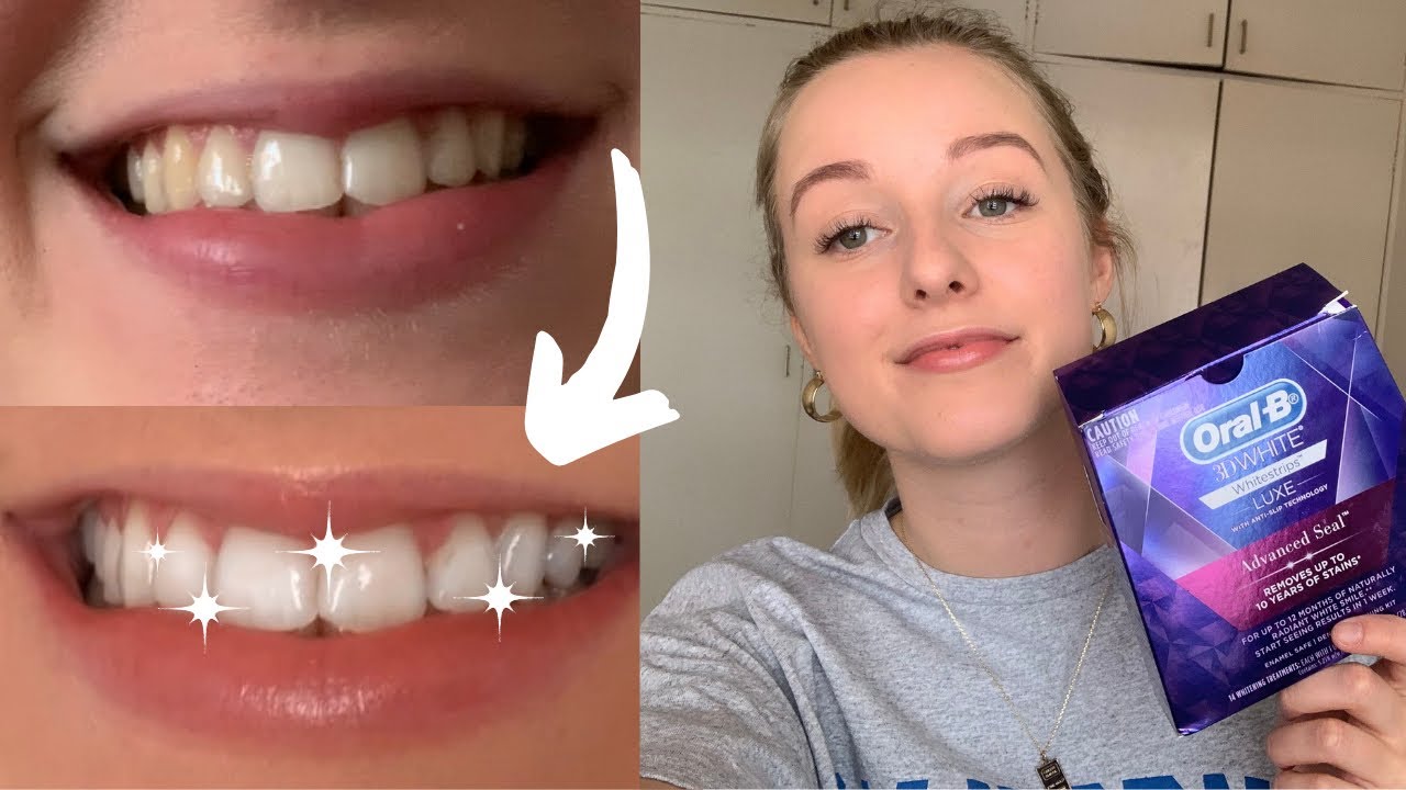 Oral B 3D White Whitestrips | Results Sensitivity