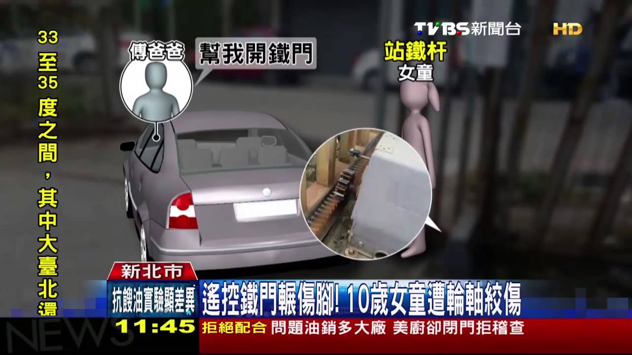 遙控鐵門輾傷腳！　10歲女童遭輪軸絞傷