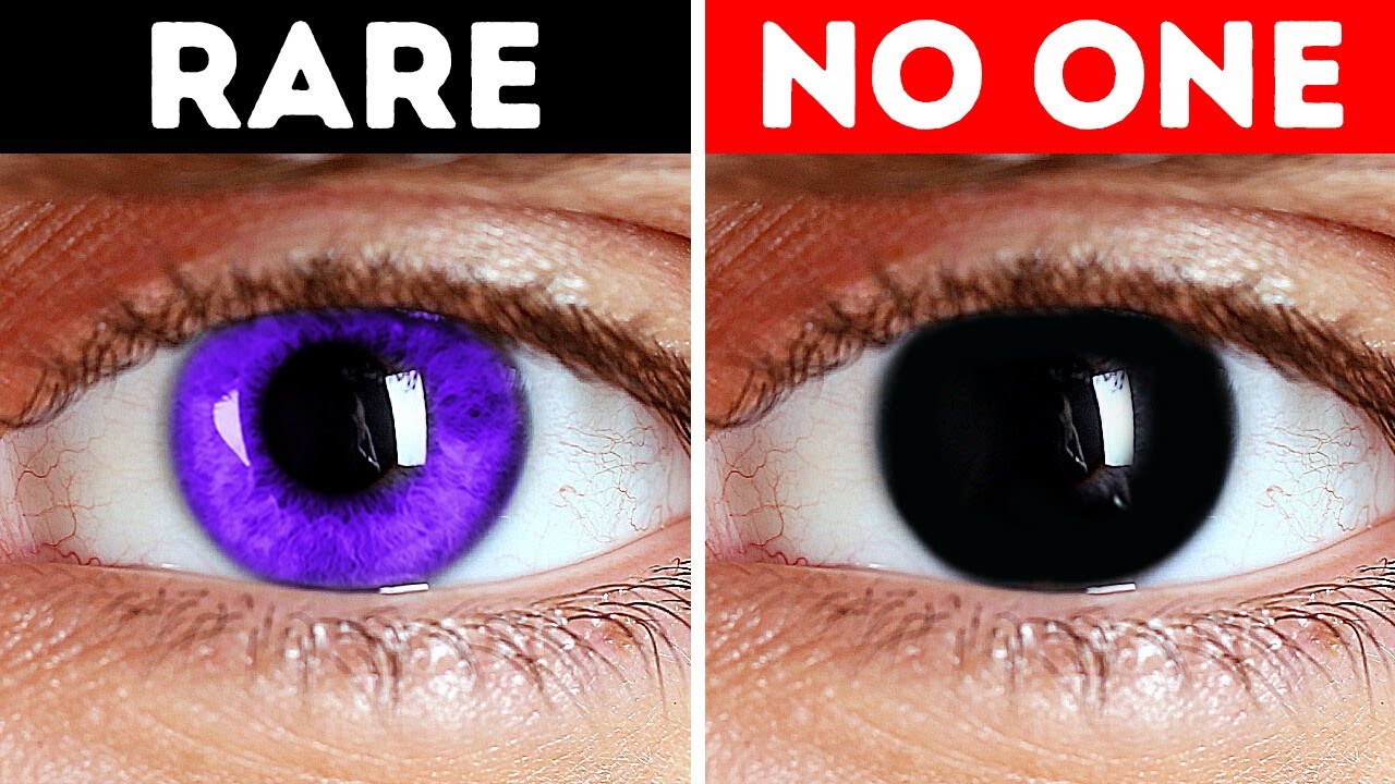 Why Can't You Have Black Eyes + Other Body Facts