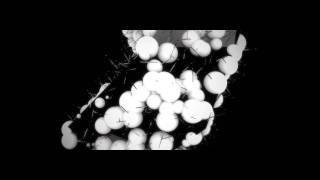 Taprikk Sweezee - Volt (kidkanevil Remix) - Official Video