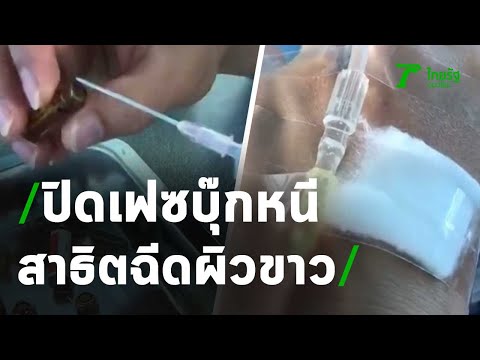 ฉีดผิวขาว