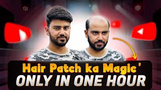 “Hair Patch Treatment LIVE | Shocking Result in 1 Hour 😱”