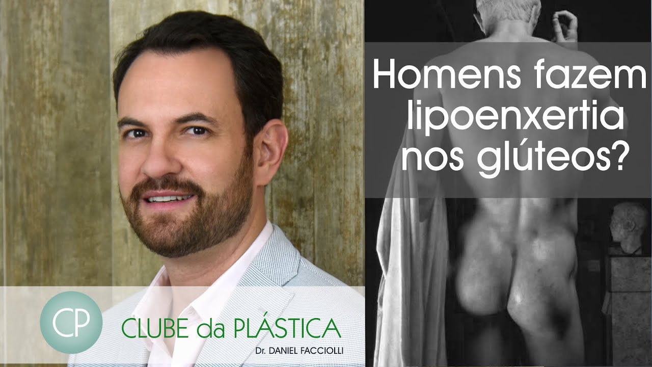 Watch Now Clube da Plástica: Homens fazem lipoenxertia nos gluteos Clube da Plástica: Homens fazem lipoenxertia nos gluteos